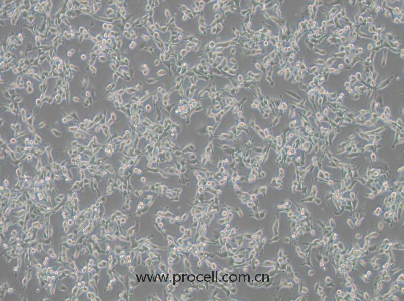 MFC细胞 (小鼠胃癌细胞) (STR鉴定正确)CL-0156