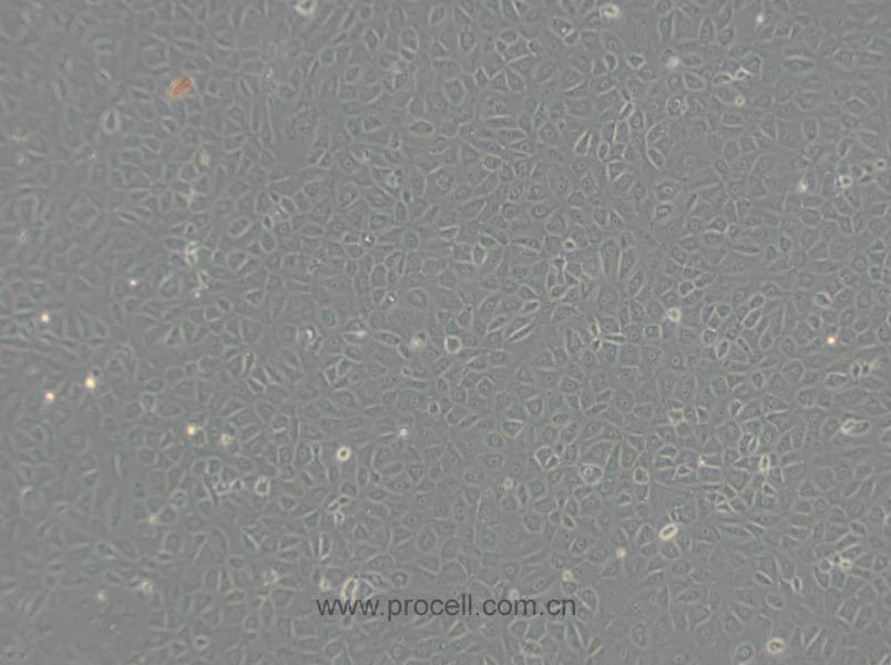 NRK-52E细胞 (大鼠肾细胞) (种属鉴定正确)CL-0174