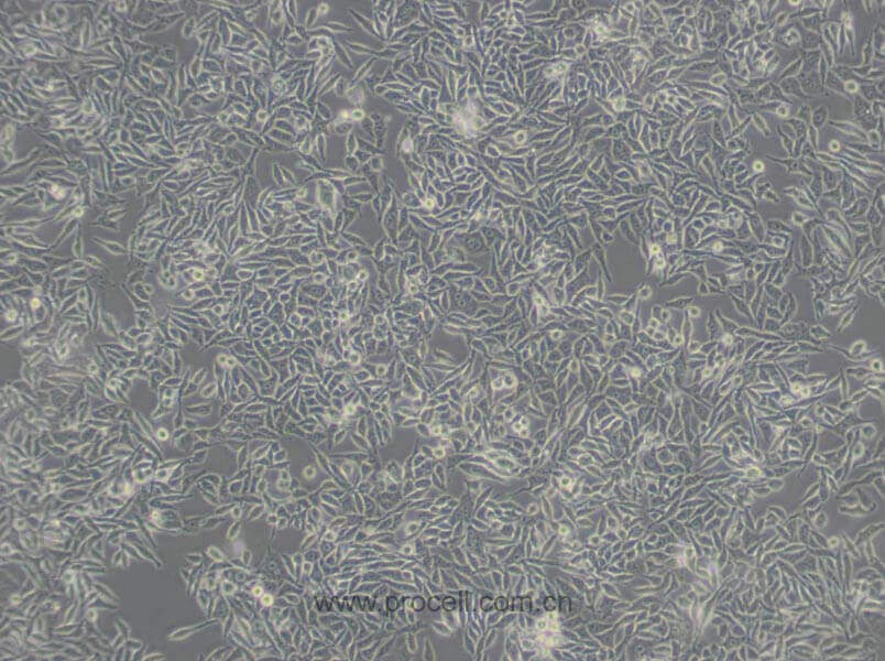 RKO细胞 (人结肠腺癌细胞) (STR鉴定正确)CL-0196