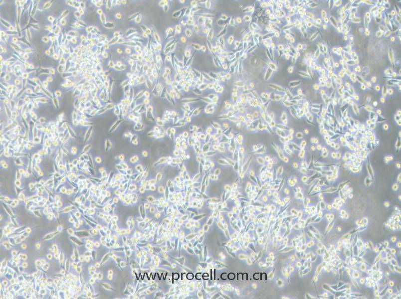 MKN-45细胞 (人胃癌细胞)(STR鉴定正确）CL-0292