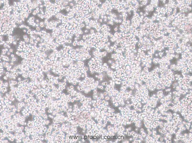 CTLL-2细胞 (小鼠T细胞) (STR鉴定正确)CL-0331