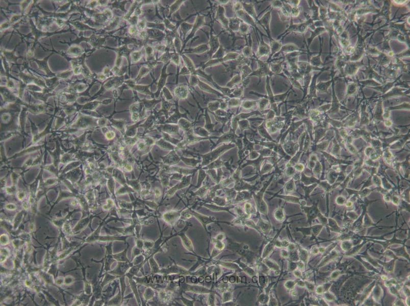 K7M2 wt 细胞[K7M2-WT细胞] (小鼠骨肉瘤成骨细胞) (STR鉴定正确)CL-0371