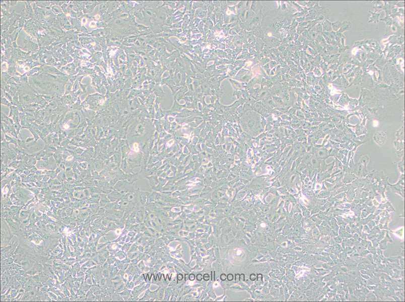 HC11细胞 (小鼠乳腺上皮细胞) (STR鉴定正确)CL-0616