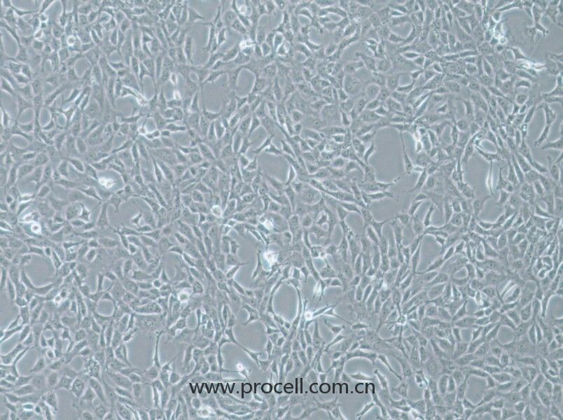 MPC-5细胞 (小鼠肾足细胞) (STR鉴定正确)CL-0855