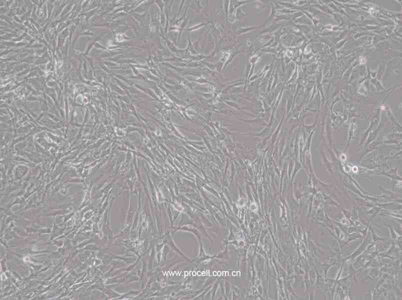 HBZY-1细胞 (大鼠肾小球系膜细胞) (种属鉴定正确)CL-0092