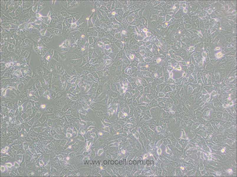 BHT101细胞 (人甲状腺癌细胞(未分化)) (STR鉴定正确)CL-0617