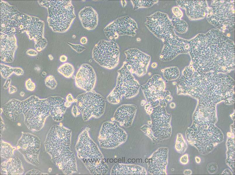 NCI-H1944细胞 (人肺癌细胞) (STR鉴定正确)CL-0632