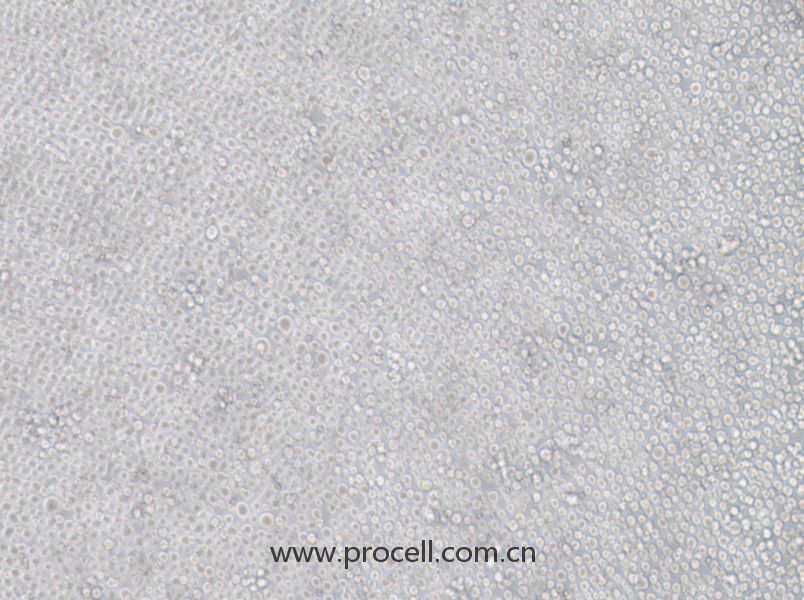 YT细胞 (人NK细胞白血病细胞) (STR鉴定正确)CL-0934