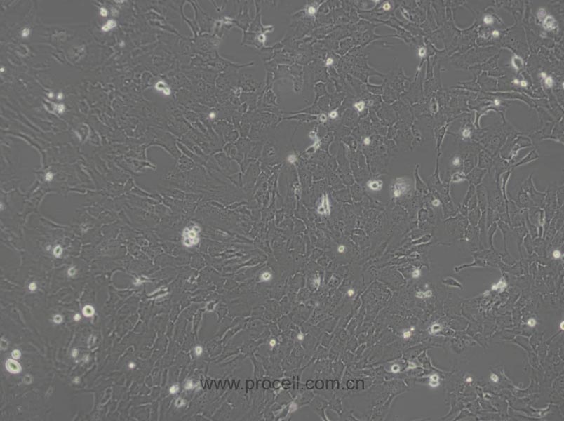 RF/6A细胞 (猴脉络膜-视网膜内皮细胞) (种属鉴定正确)CL-0194