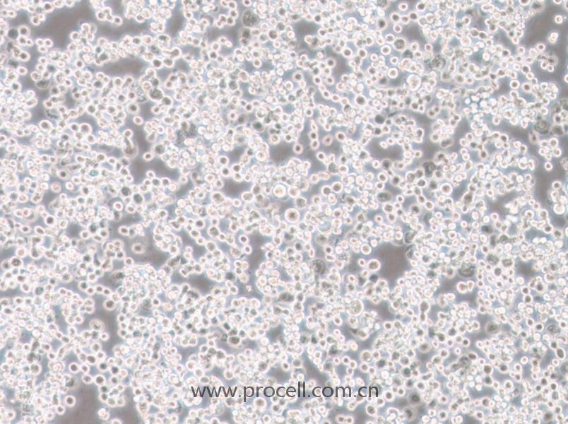 Sf21细胞 (昆虫卵巢细胞) (种属鉴定正确)CL-0204