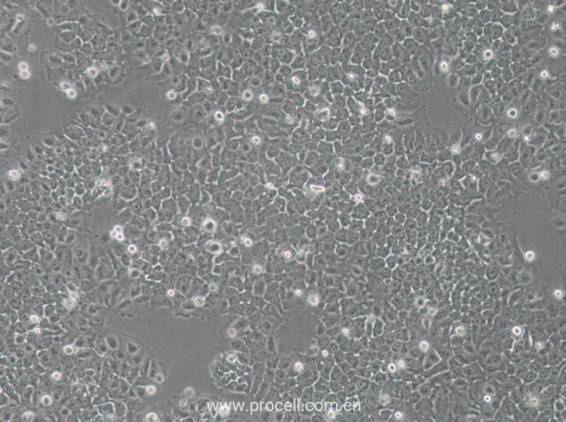 SACC-83细胞 (人涎腺腺样囊性癌细胞) (STR鉴定正确)CL-0796