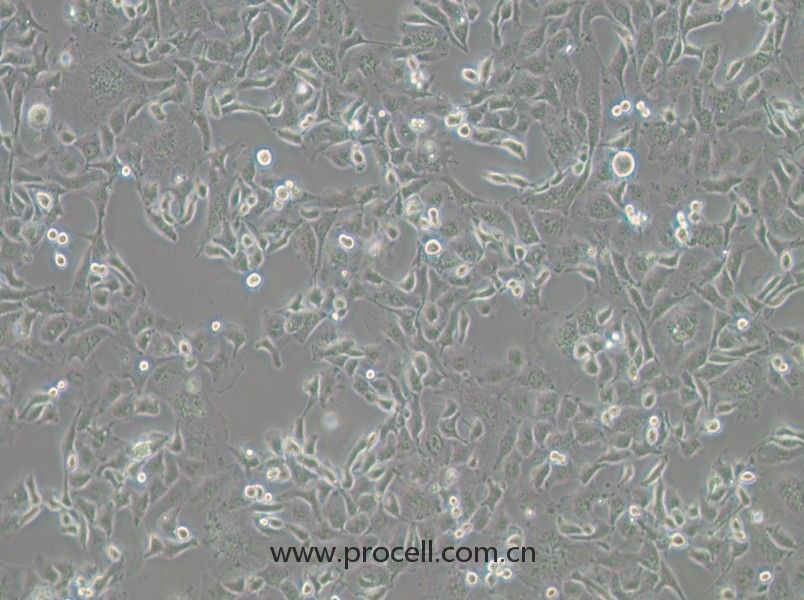 Anglne细胞 (人卵巢癌细胞) (STR鉴定正确)CL-0024