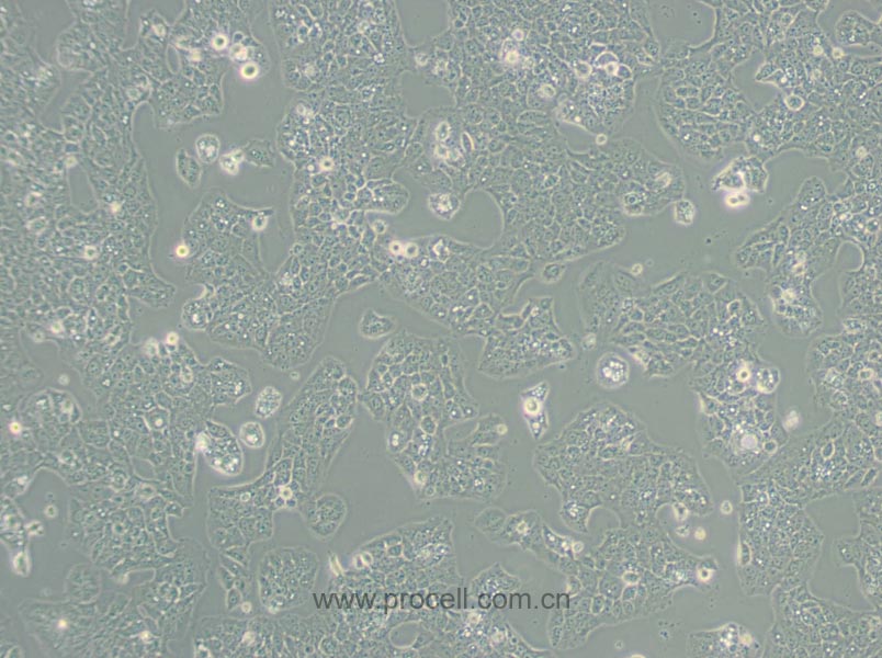 MS751细胞 (人子宫颈表皮癌细胞) (STR鉴定正确)CL-0387