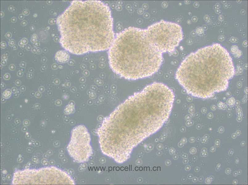 MT-4细胞 (人T细胞白血病细胞) (STR鉴定正确)（仅提供冻存管）CL-0655