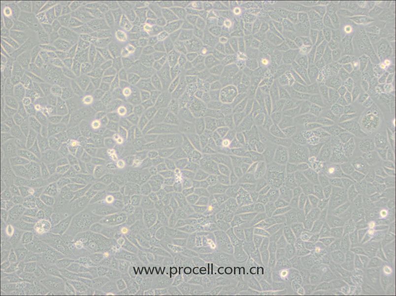 SK-LU-1细胞 (人低分化肺腺癌细胞) (STR鉴定正确)CL-0716