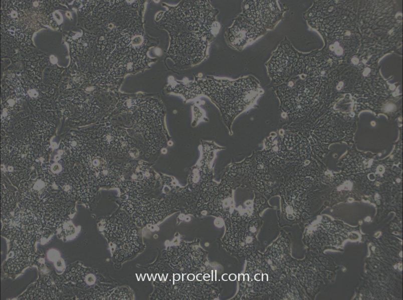 SW1417细胞 (人结肠直肠腺癌细胞) (STR鉴定正确)CL-0835