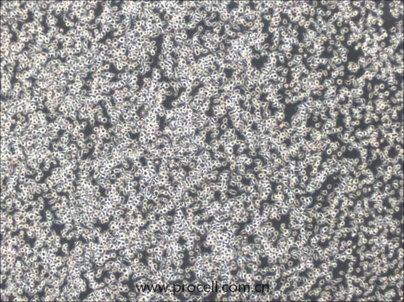 TOLEDO细胞 (人弥漫大B细胞淋巴瘤细胞) (STR鉴定正确)CL-0894