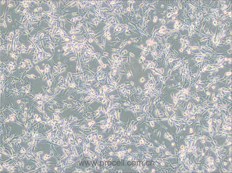 PIEC细胞 (猪髋动脉内皮细胞)(种属鉴定正确)CL-0186