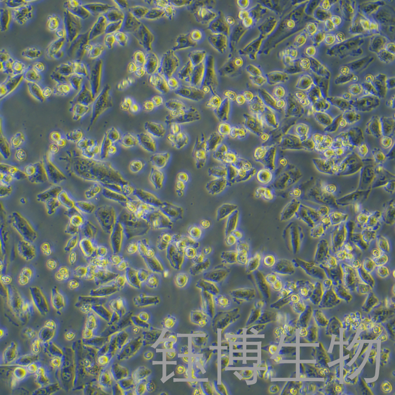 NCI-H1703（人肺鳞癌细胞）YB-71390HC