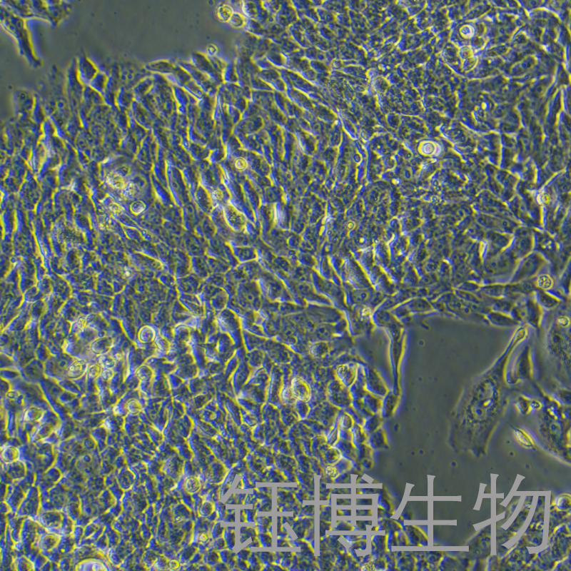 NCI-H358（人非小细胞肺癌细胞）YB-71400HC