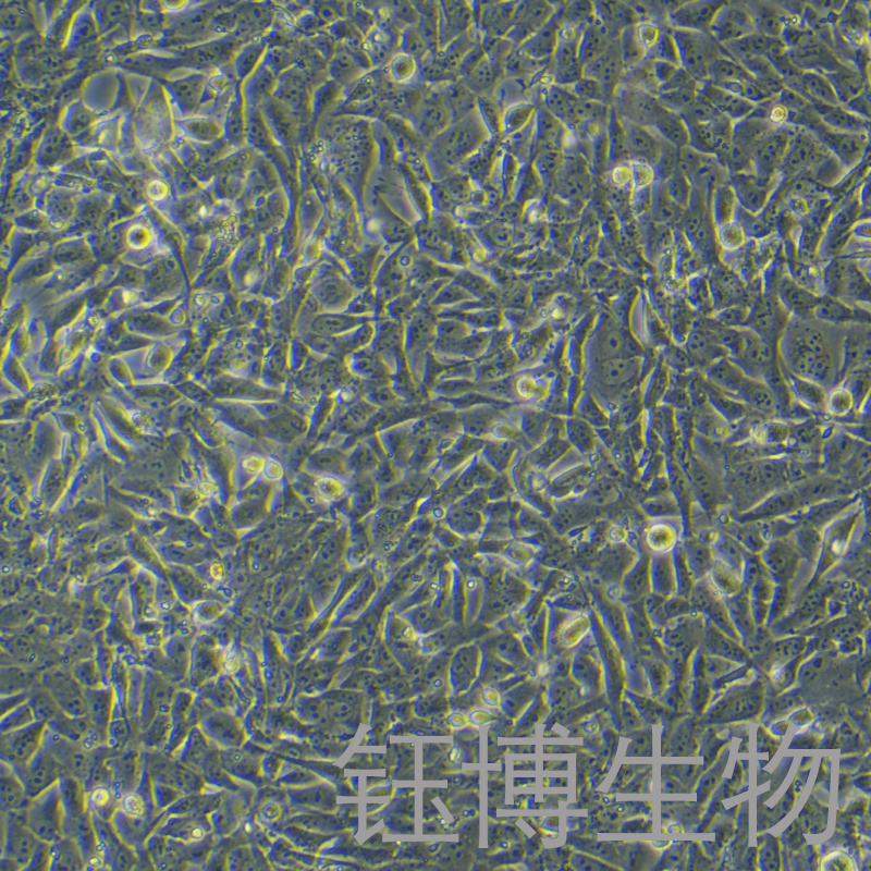 HOS（人骨肉瘤细胞）YB-71360HC