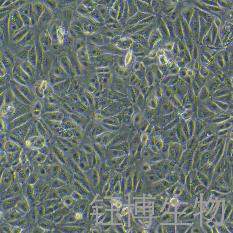 Caki-2（人肾透明细胞癌细胞）YB-71326HC