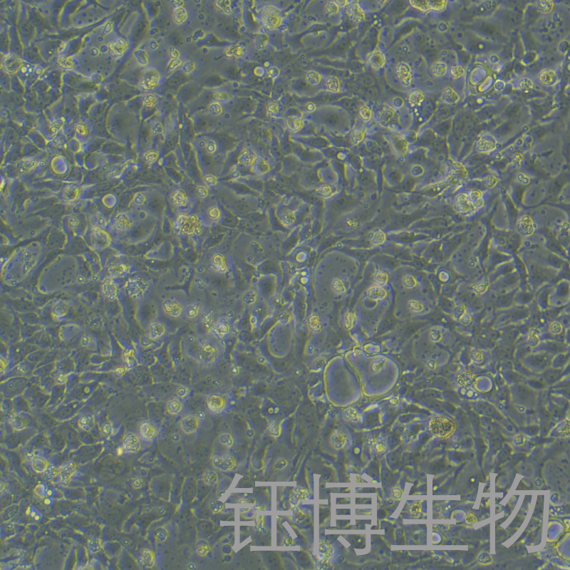 BT-20（人乳腺癌细胞）YB-71324HC