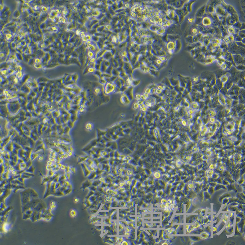 NCI-H520（人肺鳞癌细胞）YB-71402HC