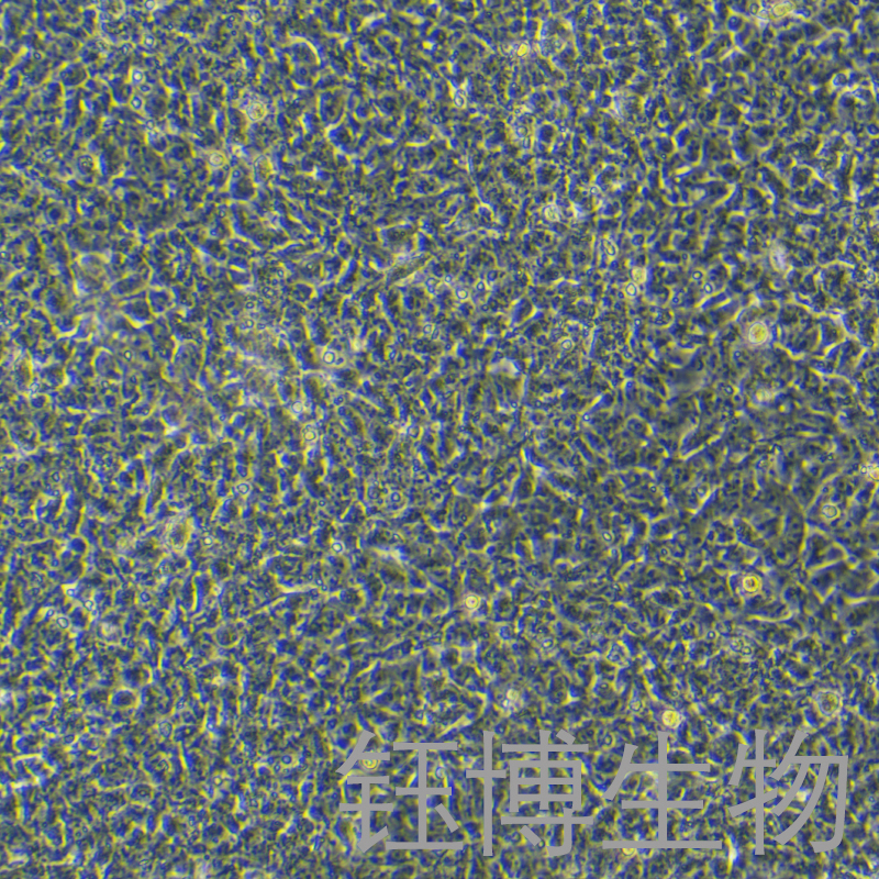 PA-1（人卵巢畸胎瘤细胞）YB-71411HC