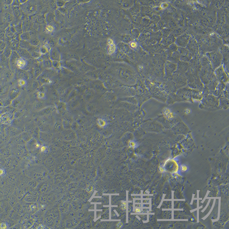 PLC/PRF/5（人肝癌亚力山大细胞）YB-71415HC