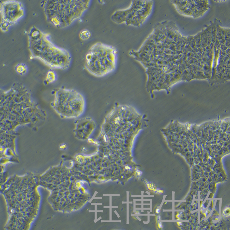 RT4（人膀胱移行细胞乳头瘤细胞）YB-71431HC