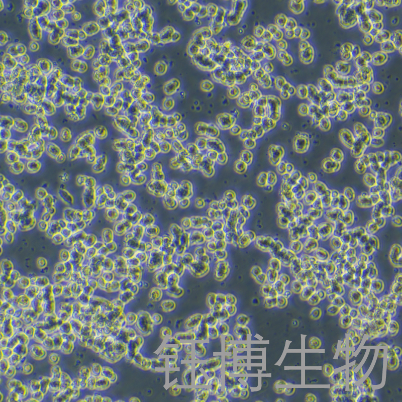 SK-NEP-1（人肾母细胞瘤细胞）YB-71442HC