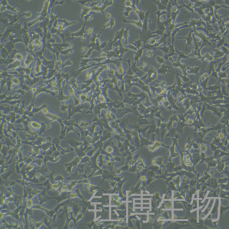 SK-N-MC（人神经上皮瘤细胞）YB-71443HC