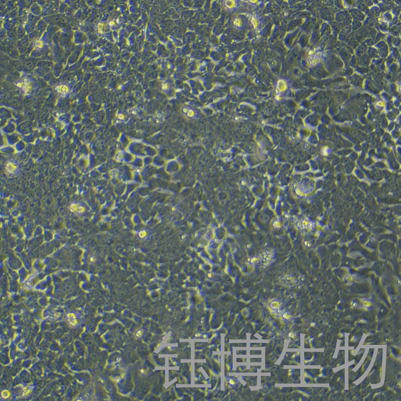 TE-10（人食管癌细胞）YB-71453HC