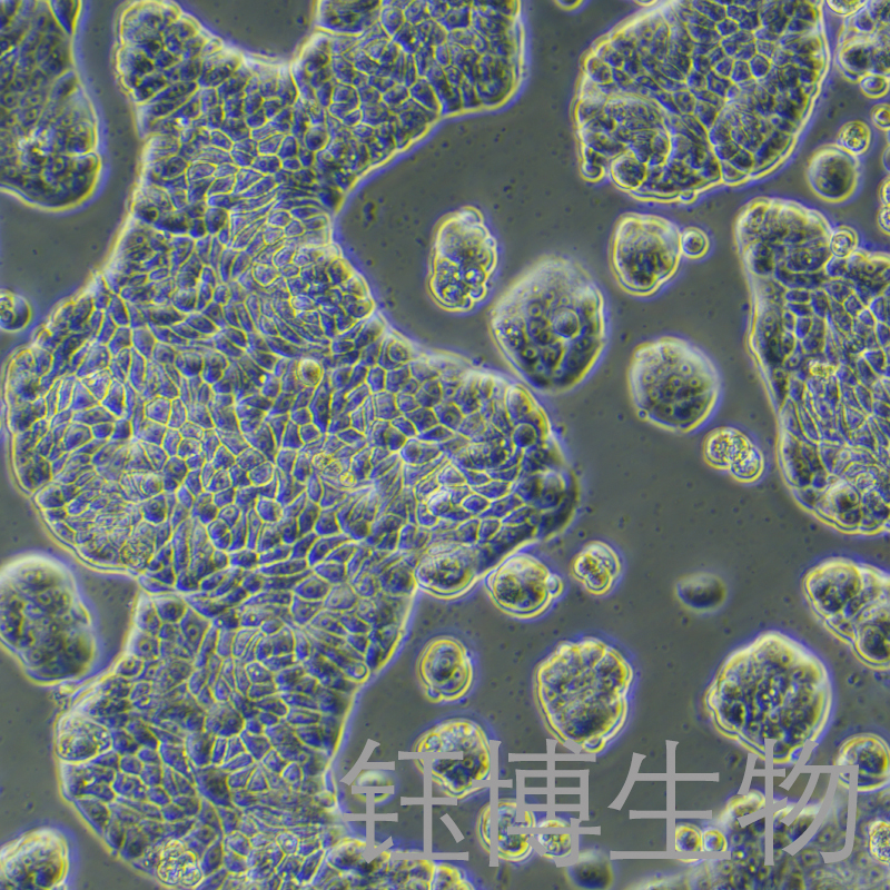 UACC-812（人乳腺导管瘤细胞）YB-71461HC