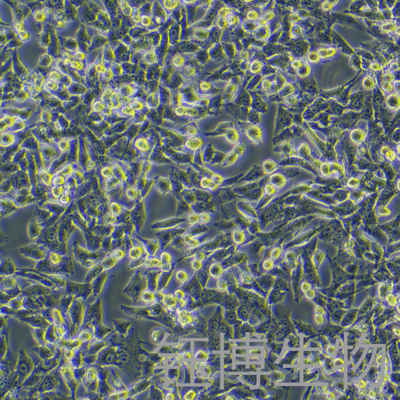 UM-UC-3（人膀胱移行细胞癌）YB-71463HC