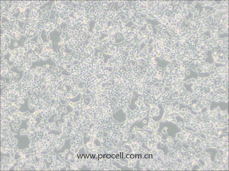 293E细胞 (人胚肾细胞(EBNA1基因修饰))(STR鉴定正确)CL-0311