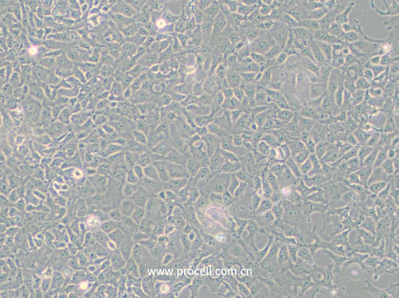 PA-1细胞 (人卵巢畸胎瘤细胞)(STR鉴定正确)CL-0411