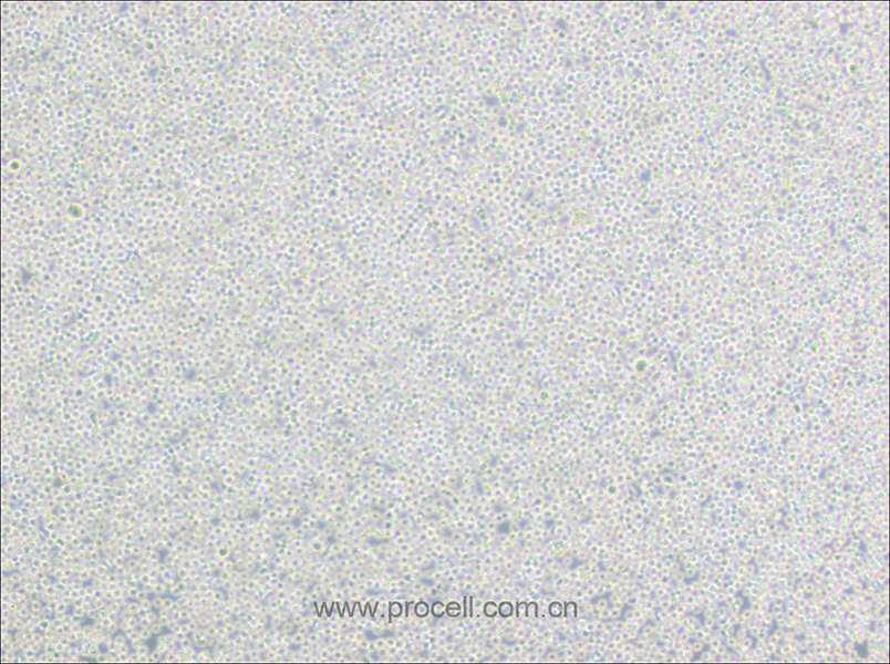 BALL-1细胞 (人B淋巴细胞急性白血病) (STR鉴定正确)CL-0587