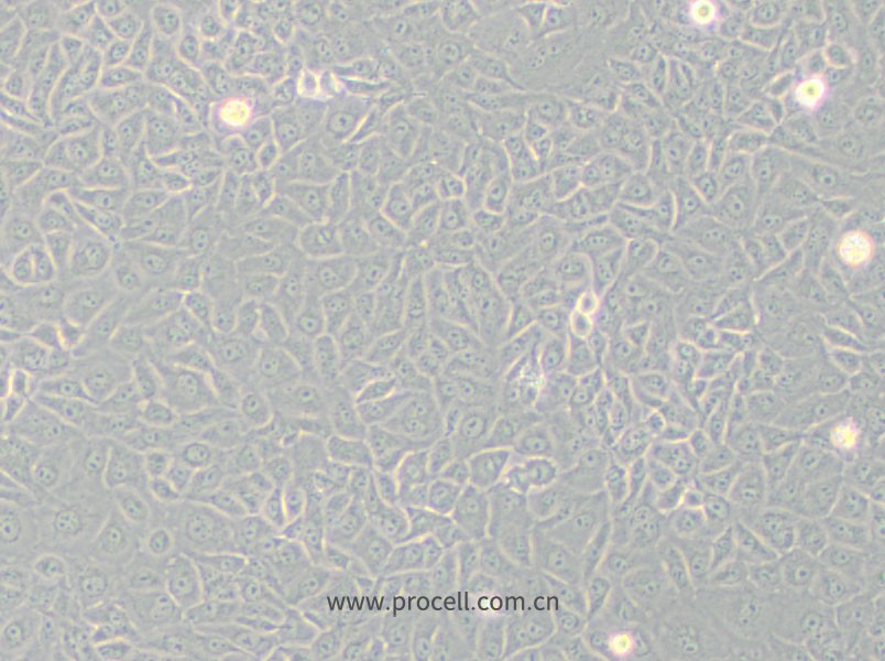 Mahlavu细胞 (人肝癌细胞) (STR鉴定正确)CL-0735