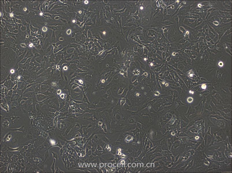 SK-GT-4细胞 (人食道癌肿瘤细胞) (STR鉴定正确)CL-0874