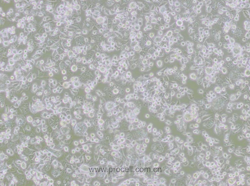 DH82细胞 (犬巨噬细胞/狗肾恶性组织细胞增生症细胞)(种属鉴定正确)CL-0073