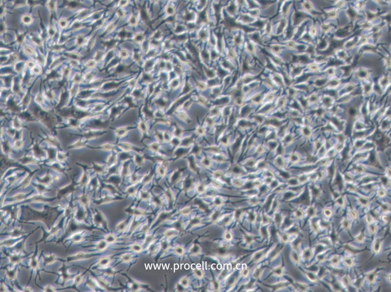 B16-F1细胞 (小鼠黑色素瘤细胞) (STR鉴定正确)CL-0318