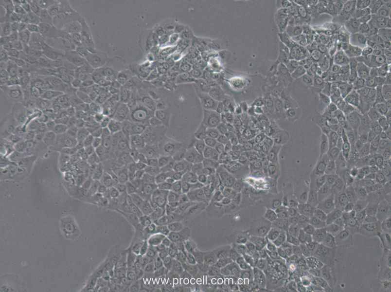 HT-3细胞 (人子宫颈癌细胞) (STR鉴定正确)CL-0630