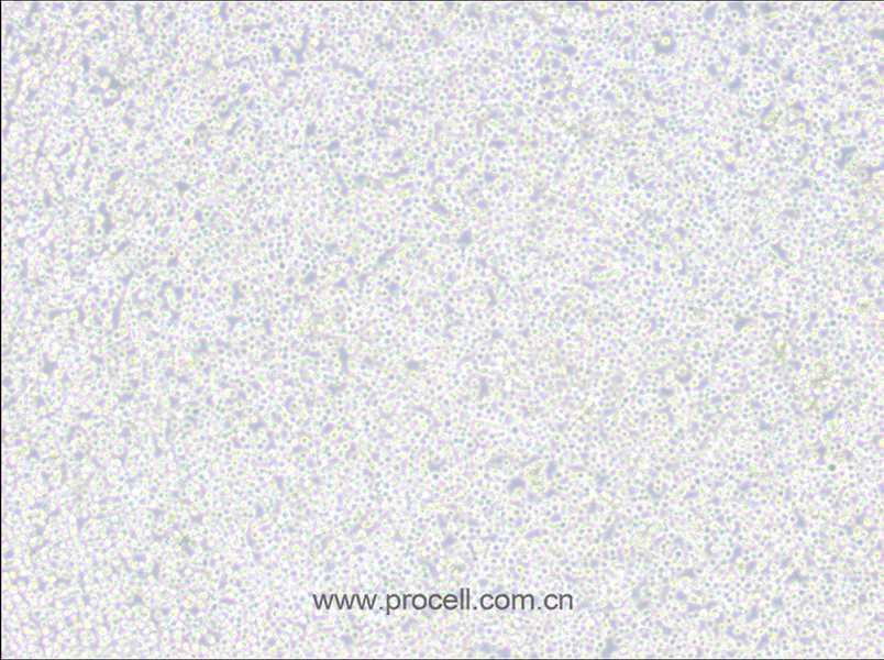 MEL细胞 (小鼠红白血病细胞) (STR鉴定正确)CL-0664