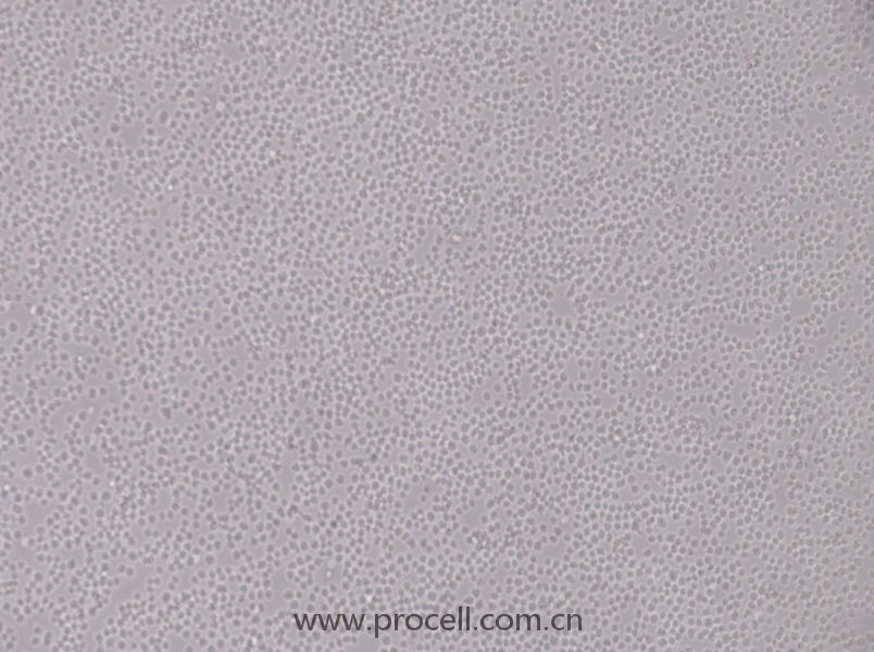 SU-DHL-8细胞 (人B细胞淋巴瘤细胞) (STR鉴定正确)CL-0871