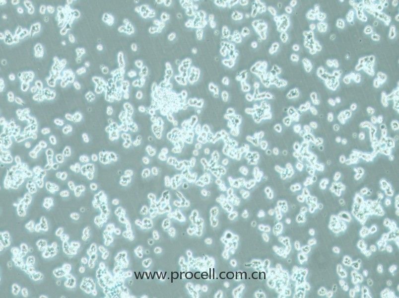 alpha TC1 clone 6细胞 (小鼠胰腺α细胞) (STR鉴定正确)CL-0985