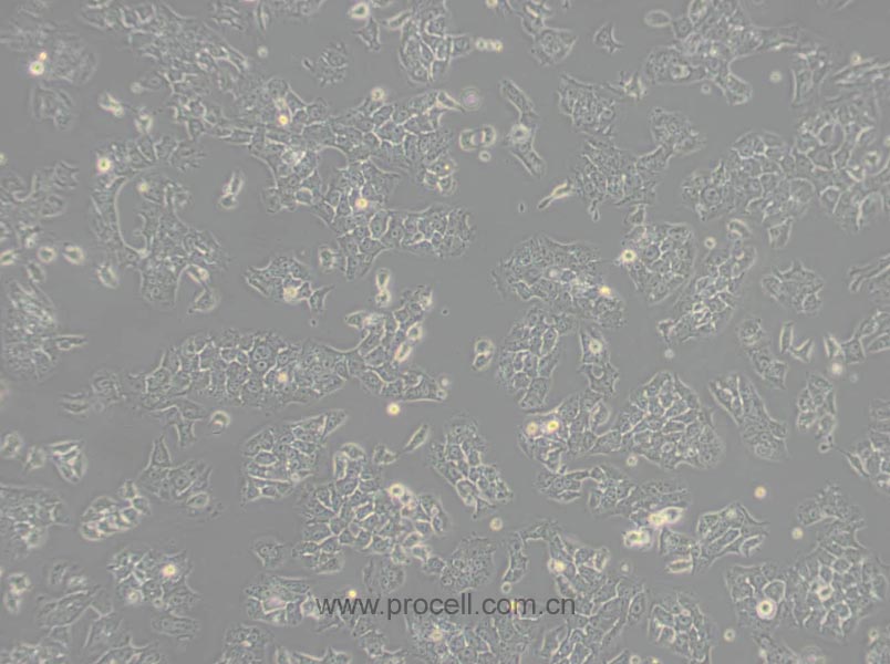 RH-35细胞 (大鼠肝癌细胞) (种属鉴定正确)CL-0195
