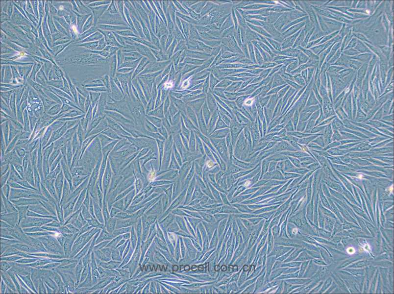 NCI-H1563细胞 (人非小细胞肺癌细胞) (STR鉴定正确)CL-0646