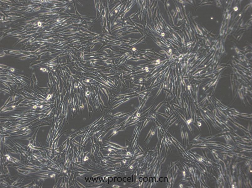 MeWo细胞 (人恶性黑色素瘤细胞) (STR鉴定正确)CL-0877